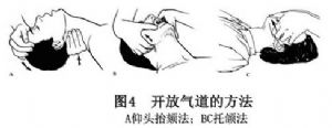 创伤患者若有颈椎损伤,不宜扳动颈部,可改用托颌法,向前