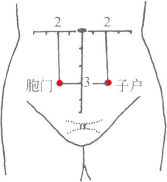 胞门,子户