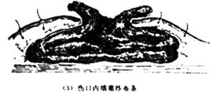 词条正文