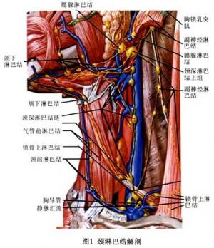 颈部淋巴结转移癌