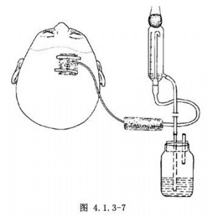 脑室穿刺和引流术