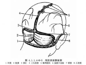 颅后窝减压术_拼音,英文_医学百科