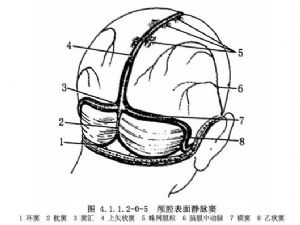 颞下减压术