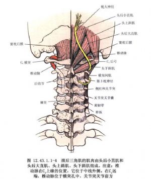 不用内固定法枕～c3融合术