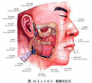 腮腺管涎石摘除术