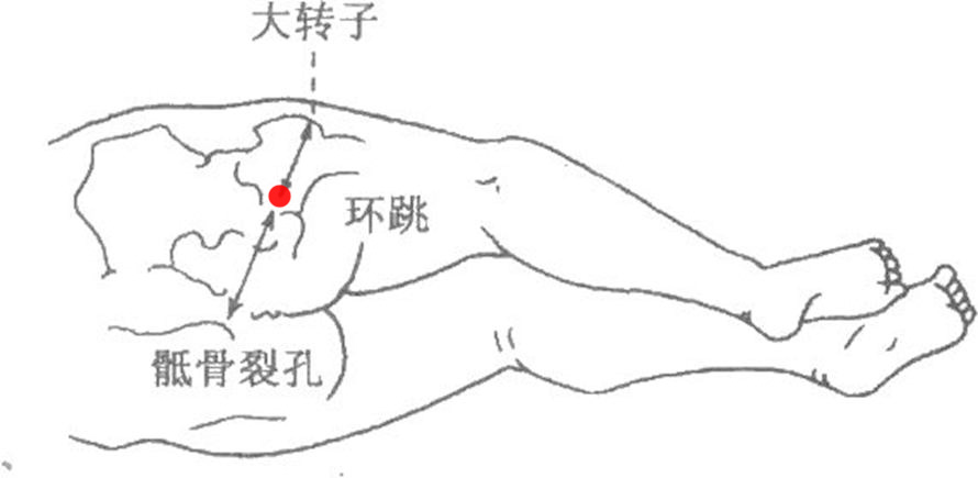 见《针方六集》.即环跳[参考资料] 高忻洙,胡玲主编.