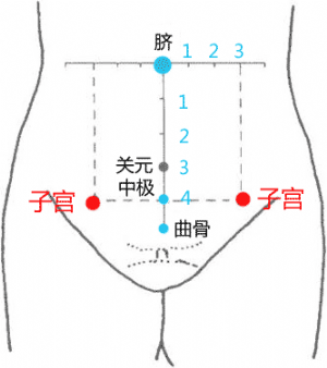子宫针灸位置示意图图片