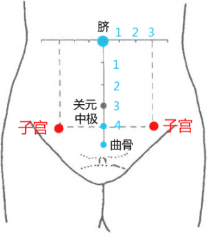 经外奇穴——子宫穴的位置