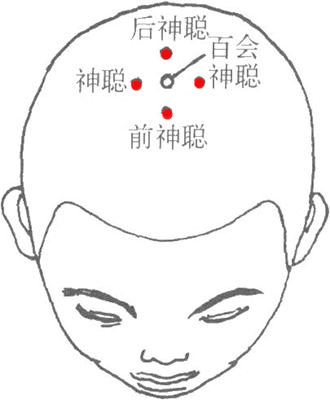 四神聰穴的位置