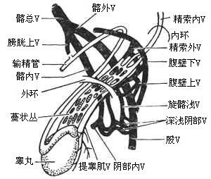 精索静脉曲张_精索静脉曲张的病因病机,临床表现,症状,病理,诊断,治疗