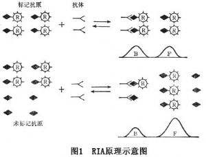 引流器排泄怎么用十二指腸引流液胰蛋白酶_https://www.jmylbn.com_新闻资讯_第2张