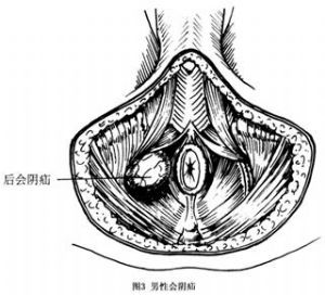 会阴疝 词条正文会阴疝临床极为少见,常误诊为大阴唇囊肿(巴氏腺囊肿)