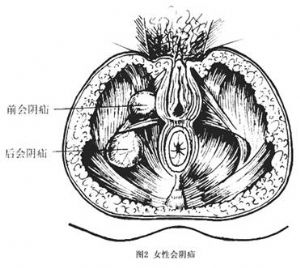 巴氏腺图图片