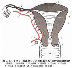 双输尿管畸形的手术治疗