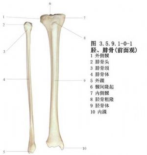 脛骨骨折螺釘內固定術 手術 醫學百科
