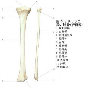 脛骨骨折螺釘內固定術 醫學百科