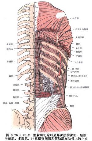 luque棒内固定方法