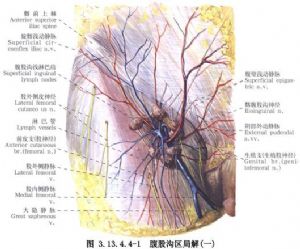腹股沟部肿瘤切除术