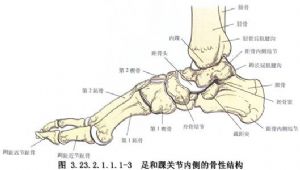 跟距关节和距舟关节固定术