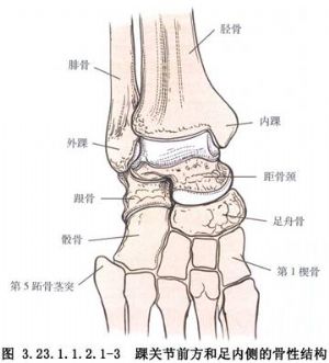 胫骨与距骨颈融合术