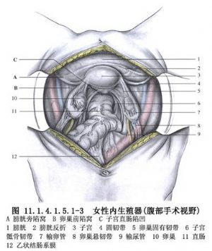 盆腔脓肿的手术_良性疾病手术,妇科手术,手术,盆腔炎症性手术,腹部