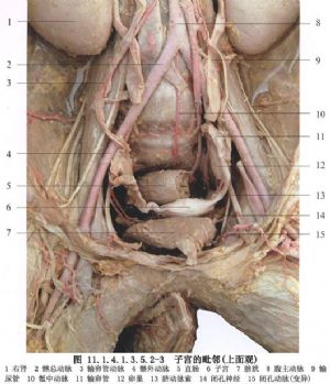 经腹全子宫切除术_良性疾病手术,妇科手术,手术,子宫切除术,子宫肌瘤