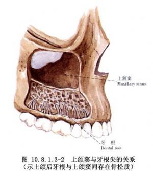 上颌骨leforti型截骨前移术_上颌骨畸形的手术矫正,手术,口腔科手术
