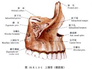上颌骨前份截骨后移术_上颌骨畸形的手术矫正,手术,口腔科手术,正颌
