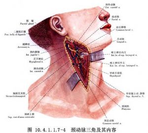 腮腺瘘图片
