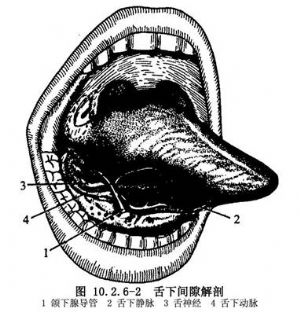 舌下间隙脓肿切开引流术