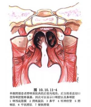 经过许多学者长期的探索,在重建腭咽闭合上逐渐形成了腭成形术与咽