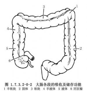 横结肠双腔造口术