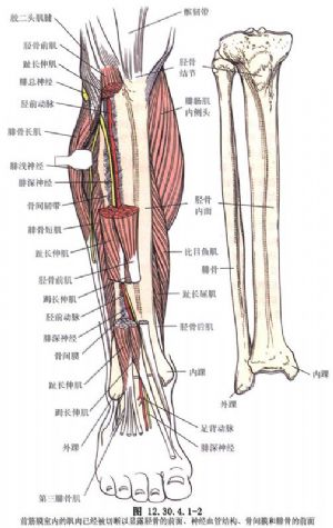 胫骨结节骨钉插入术