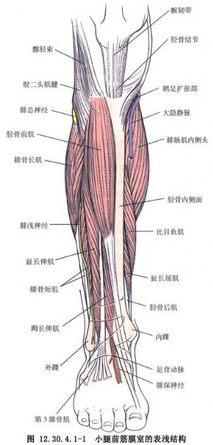 胫骨结节骨钉插入术