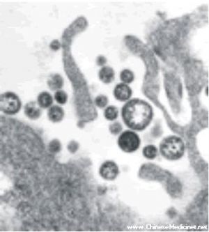 拉沙热病毒电镜扫描图